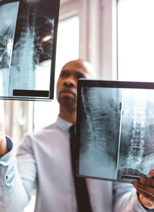 doctor reading the x-ray in the office