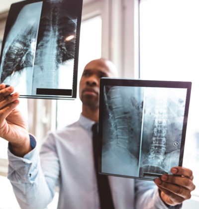 doctor reading the x-ray in the office