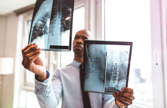 doctor reading the x-ray in the office