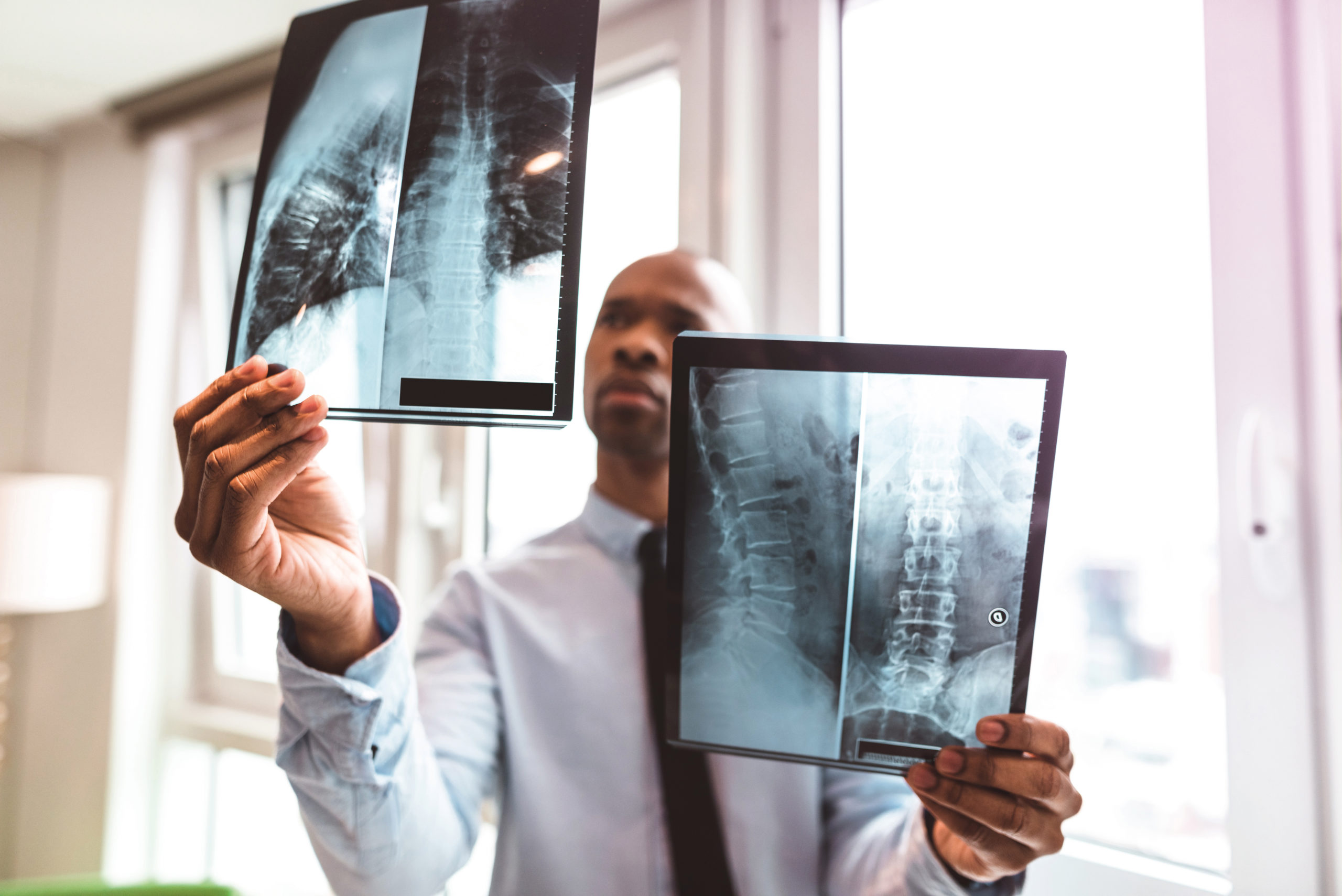 doctor reading the x-ray in the office