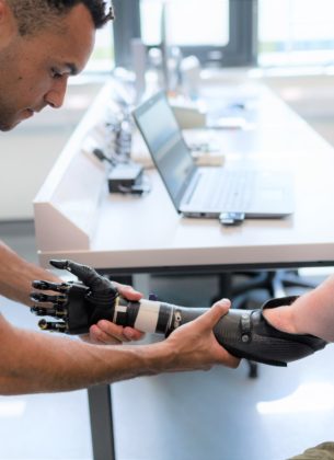 Physiotherapist helps a man to try out a prosthetic arm